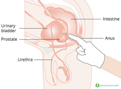 digital rectal exam