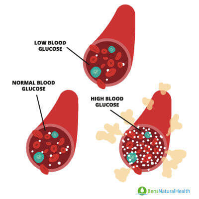 hypoglycemia vs hyperglycemia