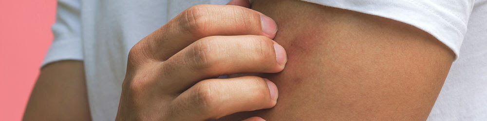 diabetes-rash