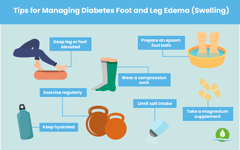 Diabetes Swollen Feet How To Treat Swelling In The Legs