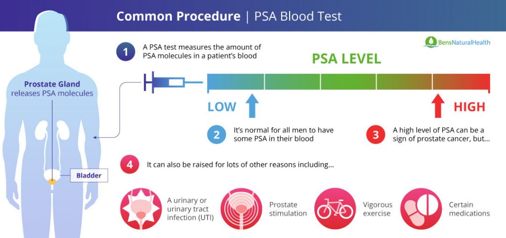 prostate cancer blood test psa level)