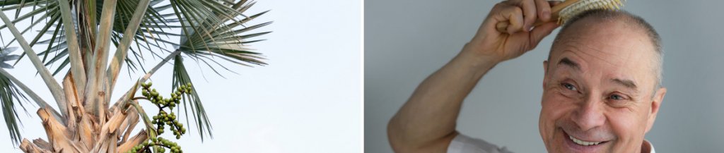 saw palmetto for hair loss