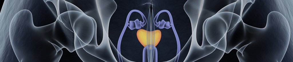 inguinal hernia