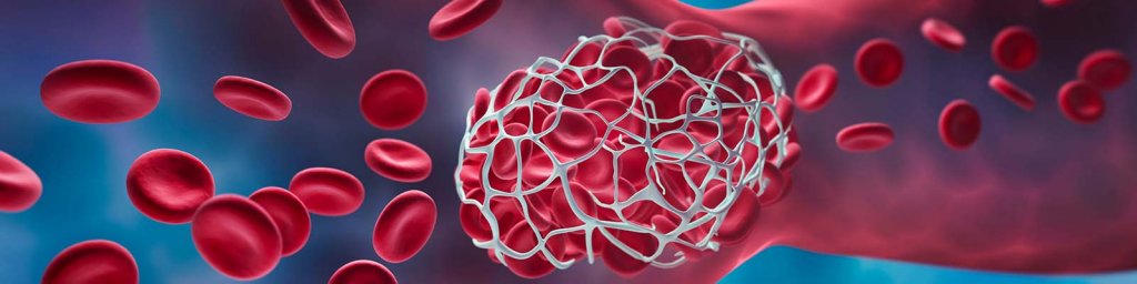 how to prevent blood clots