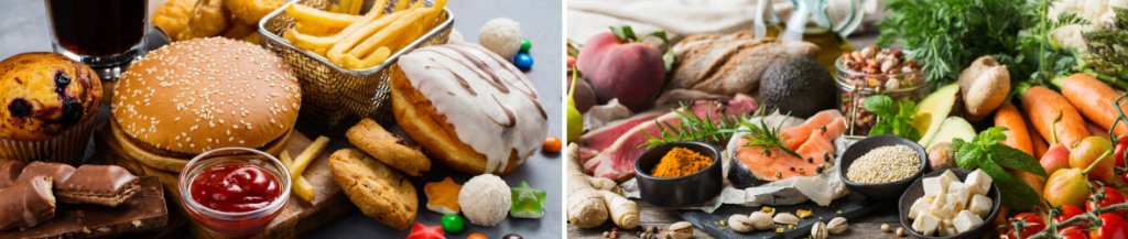 ibs diet