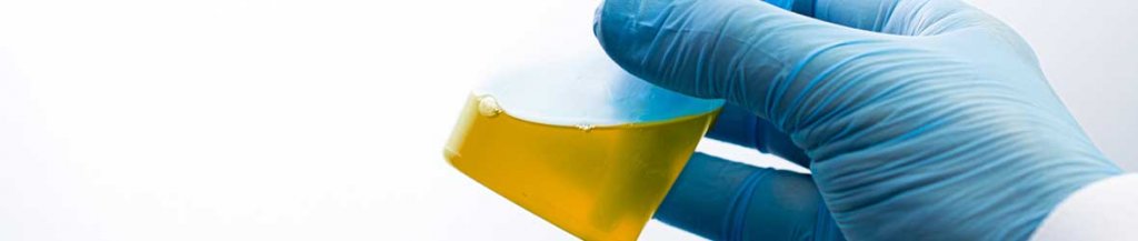 mucus in urine