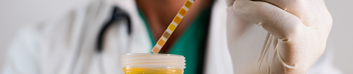Protein In Urine Proteinuria Symptoms Causes Treatment