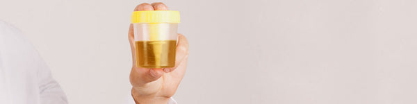 Doctor Answers: Post Void Residual Urine