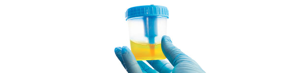 Doctor Answers: Semen in Urine?